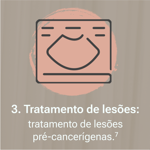 ⁠Tratamento de lesões: tratamento de lesões pré cancerígenas.7